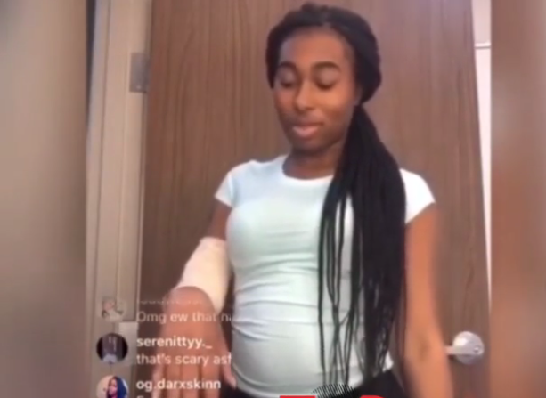 Lapattra Jacobs Shows Her Injuries After Being Stabbed BY Iyanna Mayweather